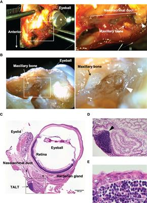 Characterization of M Cells in Tear Duct-Associated Lymphoid Tissue of Mice: A Potential Role in Immunosurveillance on the Ocular Surface